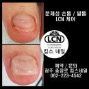 킴스케어시스템 이미지