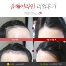 윤헤어라인의원