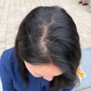 합정오토 | 출산 후 정수리 관리 두피 문신 후기 (합정 유주얼)