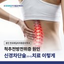 현대제일마취통증의학과의원 | 봉천 현대제일마취통증의학과 척추전방전위증 원인과 신경차단술(주사) 치료 이렇게