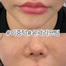 써니스킨케어 이미지