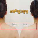 산본역 4번 출구 앞 버스정류소 | 비대칭 얼굴 고민이라면 압구정에스테틱 위뷰티 압구정점 승모근관리