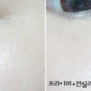 림팩트 이미지