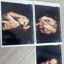 익산제일병원 | 20주차 익산 제일산부인과 정밀초음파 후기
