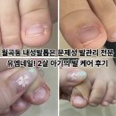 월곡동8 | 월곡동 내성발톱은 문제성 발관리 전문 유엠네일! 2살 아기의 발 케어 후기