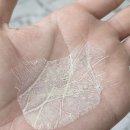 아이템스팟 | 비렌느 스팟엑스 후기 쥐젖 편평사마귀 비립종 사용방법 한달변화