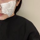 안녕펫 | 홍대피부과 얼굴제로펫 3회차 후기, 얼굴살빼는 방법, 심부볼살 빼기