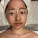 수원피부관리 애띠애 피부샵 돌고돌아 다시 여기로. 트로이필 1회차 후기