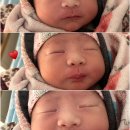 오창사랑의원 | 오창 미즈산부인과 제왕절개 6박7일 입원 후기