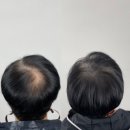 대전두피문신 잘하는곳 찾기 힘드시죠?