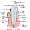 당신의 잇몸은 건강하십니까? 이미지