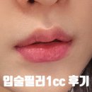 입술필러 1cc 입꼬리필러 입꼬리보톡스 후기 전후 사진 멍 붓기 통증