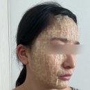연세보드미의원 네이버블로그