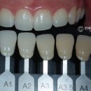 광진치과기공소 이미지