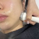 카페더마니 | 합정역피부관리 더마7 합정역점 산소필 트라이엄 레이 후기