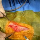 M&P Medical Agency | 고령 포메라니안 담낭 점액종 수술 성공 사례와 만성질환 동반 환자의 회복 과정