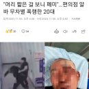 머리 짧은 걸 보니 페미.. 편의점 알바 무차별 폭행 이미지