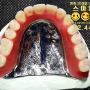 스마일기공소 이미지