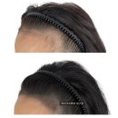 모델헤어라인 이미지