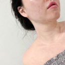 퍼나머널뷰티 | [퍼나머널 뷰티] 대구 달서구 장기동 신부관리/웨딩관리/윤관관리/리프팅 받고 온 후기