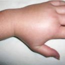 아침에한의원 이미지