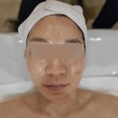 레몬트리 | 남천동 에스테틱 팔자주름 고민해결 리프팅 후기 : 레몬트리에스테틱