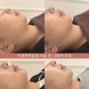 뷰티끄라인