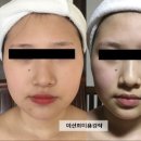 더샵피플 | 인천 송도 체형관리 경락 [선 에스테틱] 정말 만족하고 쓰는 리얼 후기😍✨