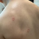 우성동물병원 | 티모한테 피부병 옮은 쭈호 동탄 리멤버피부과 다녀온 후기[내돈내산]