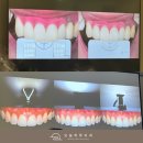 현대치과보철과치과의원 | 오늘하루치과 앞니치료연구회 2026 세미나 참석 후기 (1)