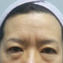 거상환경 | [부산이마거상] 이마거상 수술, 필요한 5가지 신호 완벽 정리 – 지금 거울을 보세요