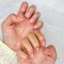 내성적인;네일&닥터아이티엔