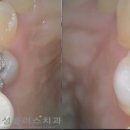 정성플러스치과 이미지