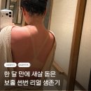 햇빛약국 | 보홀 썬번 실전 대처법! 알로나비치 TGP 약국에서 일광화상연고 구매 후기