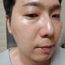 인셀덤 더마톨로지 퍼스트패키지 EX 내돈내산 후기
