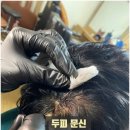 풍성풍성두피