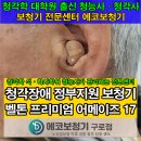 청춘보청기 | [시흥 보청기]정부 지원, 청각장애 보청기_80대 남자