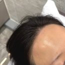 헤어프렌즈 | 강남왁싱샵 뷰티프렌즈에서 헤어라인, 인중 왁싱 받은 솔직후기