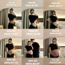 출산 기록👼🏻 (분당제일여성병원 제왕절개 후기+한성식 박사님)