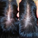 더 타이어샵 해운대좌동점 | 두피관리 [예뻐졌다 좌동점]｜해운대 두피 스케일링 + 탈모관리 후기