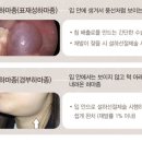 하마종 생겨본 사람 이미지