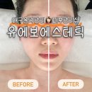 동성로 관광안내소 | 대구 얼굴경락 유에보에스테틱｜예민피부도 가능한 윤곽관리 신부관리 후기