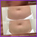 천안피부관리 피부에 생기를 부여하는 천안 프레이야