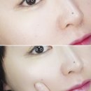 메디톡스 수분미스트 추천 얼굴 붓기까지 잡은 인생템