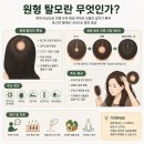 몽실비어구미공단점 | 구미 원형탈모 관리 3회차 후기 더블라인스칼프에서 변화 느끼는 중