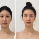 바른음식연구소 | |강남에스테틱 바른얼굴 정안| 강남피부관리와 함께 얼굴 비대칭까지 바로 잡은 후기