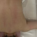 린지네일 | 통영 피부관리 린지네일앤바디 등관리 솔직후기