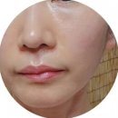 홀인원코스메틱 닥터브린셀 스템셀 골드크림 프리미엄 줄기세포배양액화장품