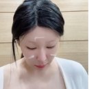 블린블린