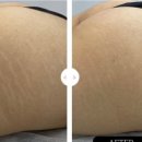 스킨52부천지부 이미지